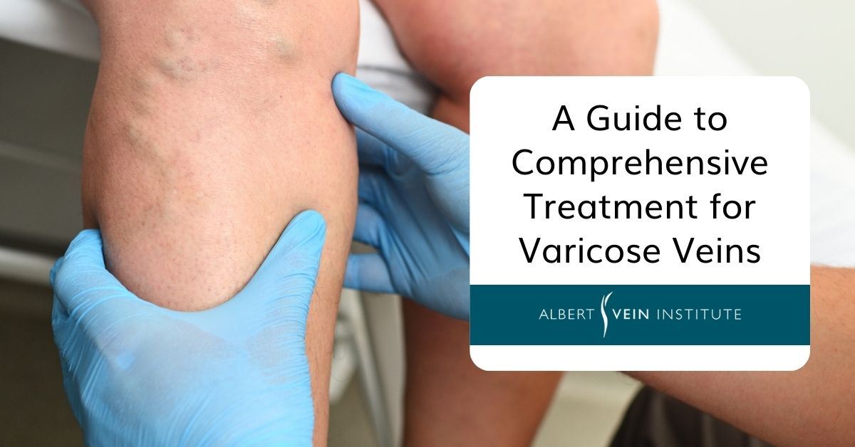 Understanding Your Treatment Options for Varicose Veins: Kunal Patel, MD,  FACC: Board Certified Cardiologist